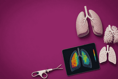 4DMedical Study Boosts Lung Surgery Success with CT:VQ™ Validation